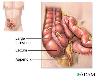 appendectomy-series.jpg